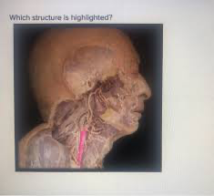 <p>Name this structure</p>