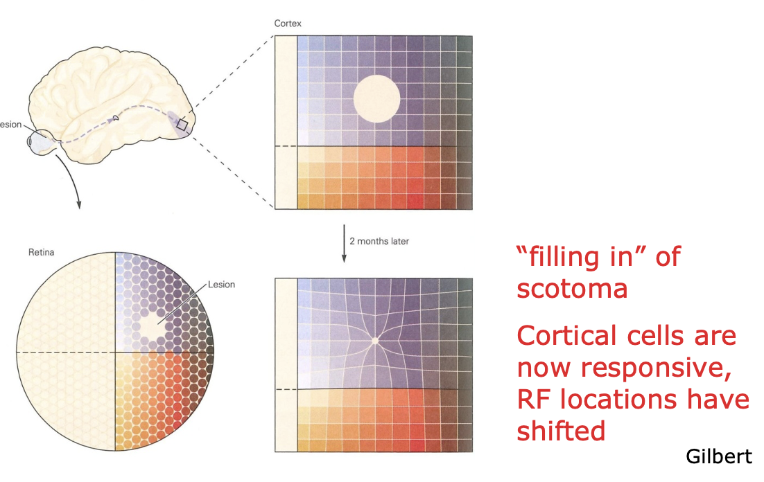 <ul><li><p>Visual space is organized like a grid on the retina</p></li><li><p>A small, targeted retinal lesion is made with a laser.</p></li><li><p>When the visual cortex is mapped right after, the part that normally gets input from that damaged retinal spot becomes silent (a c<strong>ortical scotoma</strong>).</p></li><li><p>After about two months, mapping again shows that those previously silent neurons now respond, but to areas just outside the damaged region. Their receptive fields have shifted to the edges of the scotoma.</p></li><li><p>As a result, the region of cortex representing the area around the lesion becomes enlarged, effectively “filling in” the missing visual space.</p></li></ul><p></p>