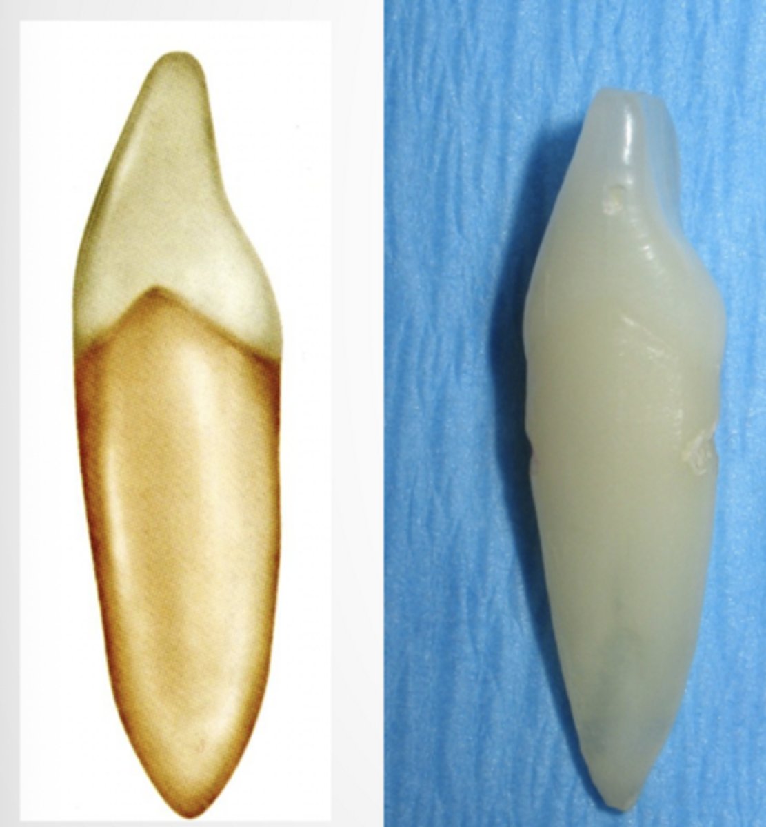 <p>- Similar to mand. cen. except distal mesial ridge may be visible in background (tooth less straight than cen. incisor)</p><p>- Mesial CEJ more curved</p>
