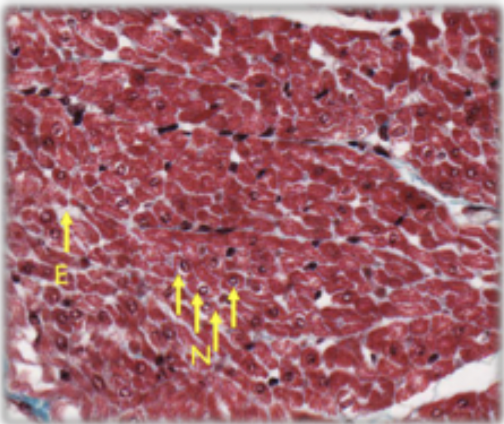 <p>cross sections of comparable size, centrally placed nucleus, endomysium is more abundant</p>