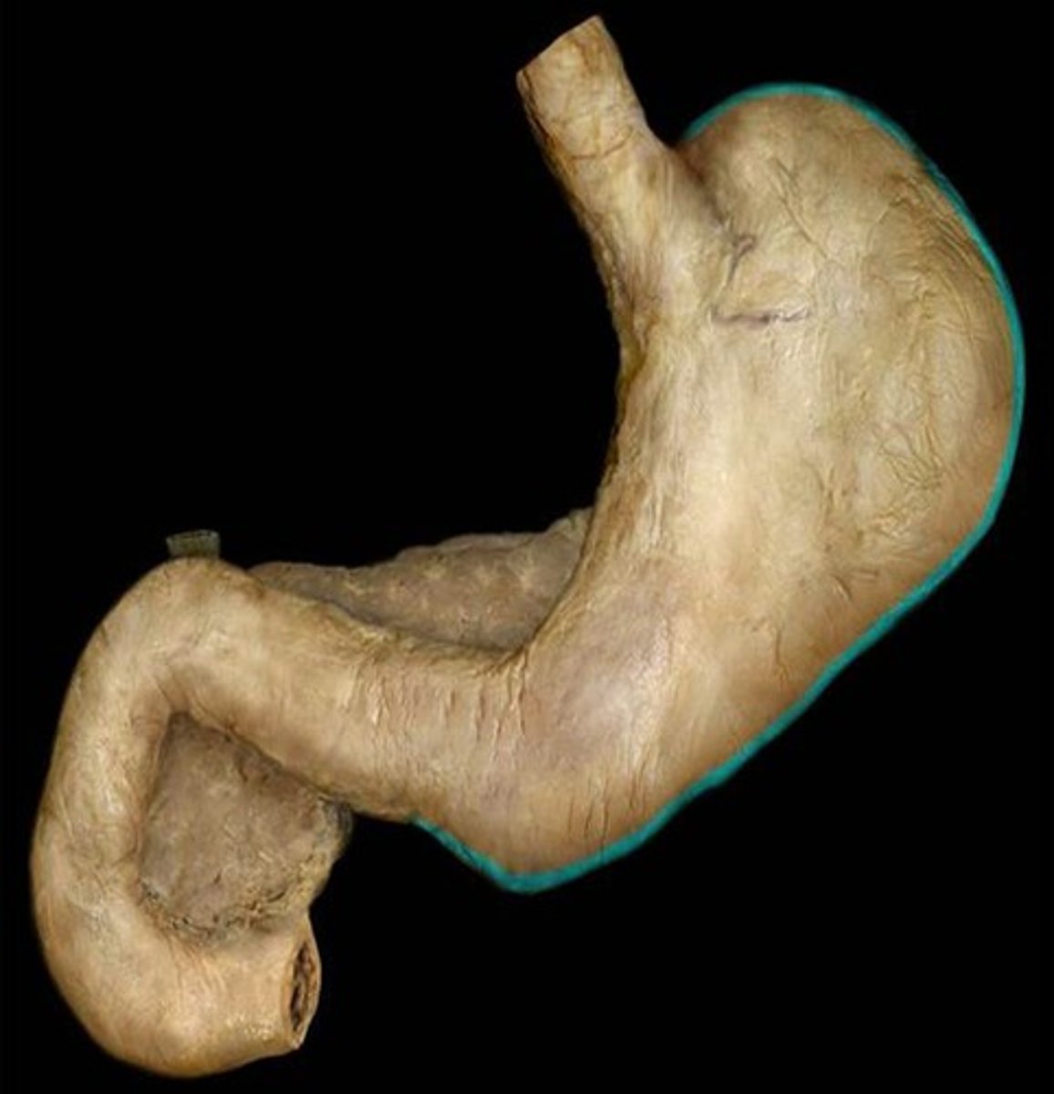 <p>Name this part of the stomach.</p>