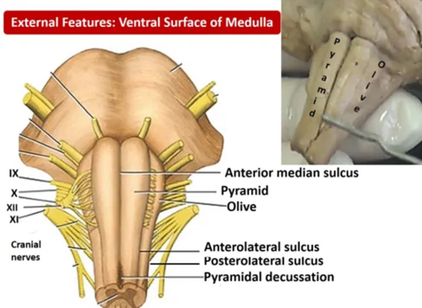 <p>- szczelina pośrodkowa przednia, oddziela piramidy rdzenia przedłużonego </p><p>- przednio-boczna (jest ograniczeniem bocznym piramidy) oraz tylno-boczna, będąca za oliwką </p>