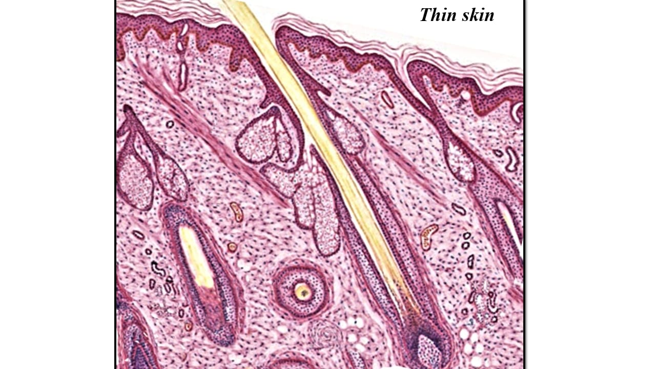<p>Thin skin – LM</p>