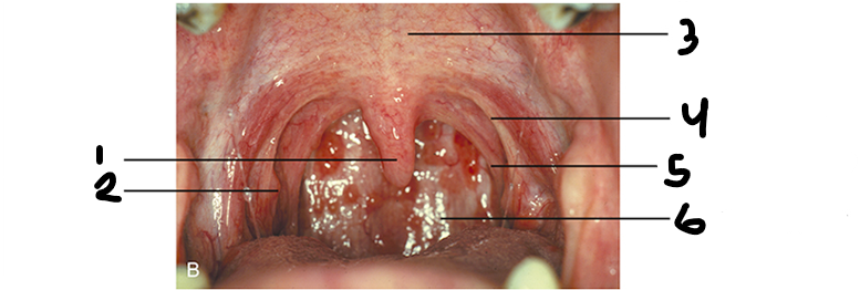 <p>Label the soft palate surfaces from 1-6</p>