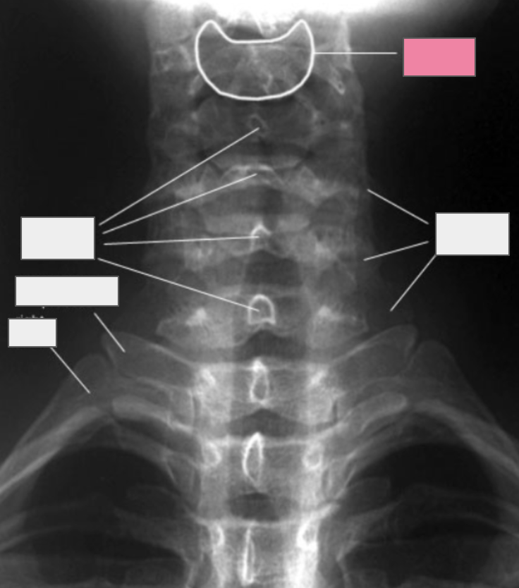 <p>What structure of the spine does the box highlighted in pink reference to?</p>