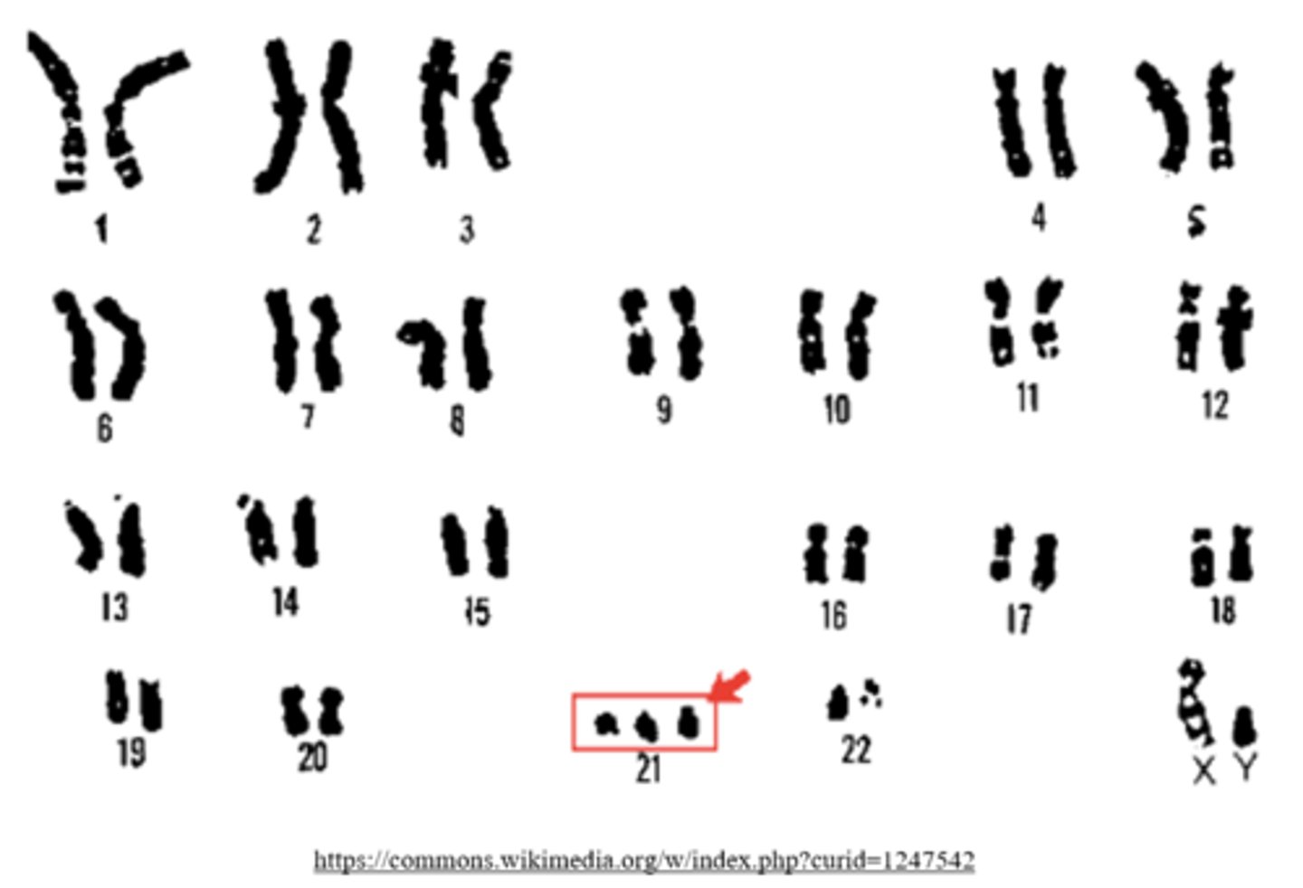 <p>trisomy</p><p>(ex: trisomy 21 = Downs syndrome)</p>
