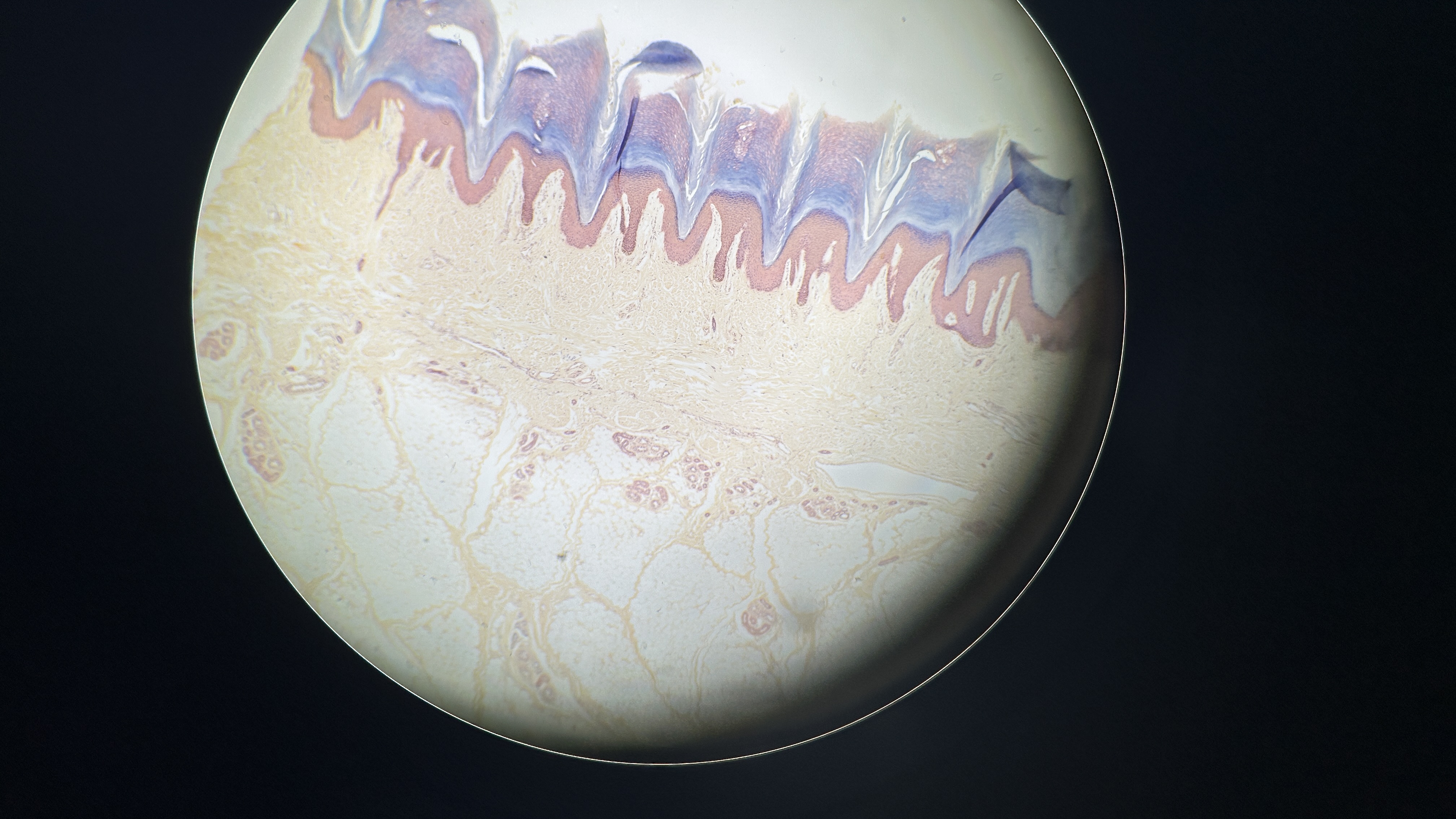 <p>What is the magnification level of the Dense Irregular CT?</p>