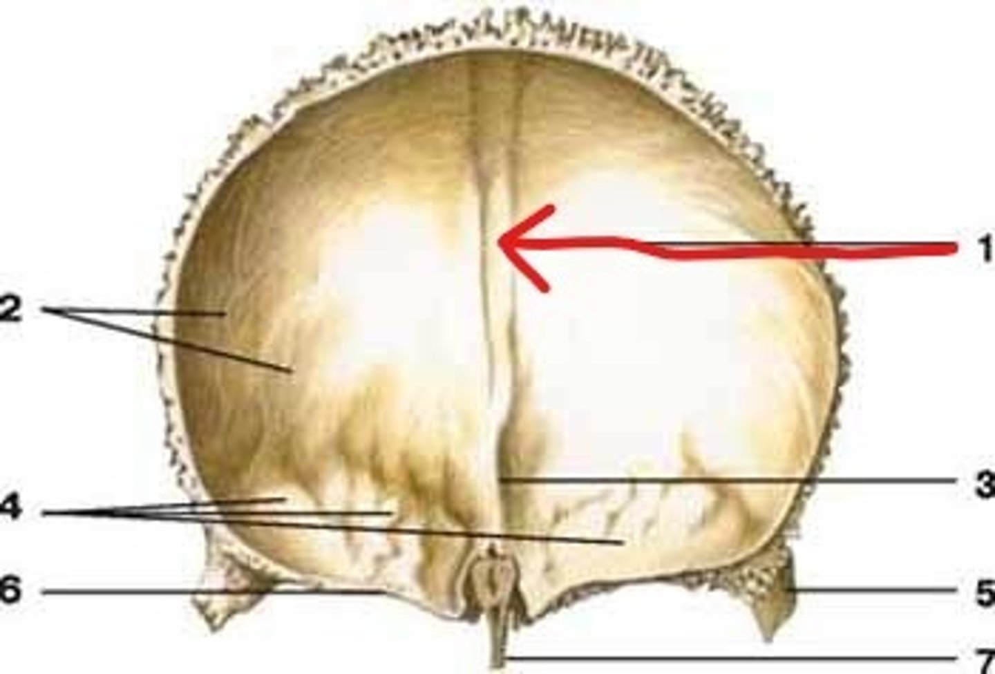 <p>vertical groove that runs down the midline of the endocranial surface, lodges superior sagittal sinus</p>