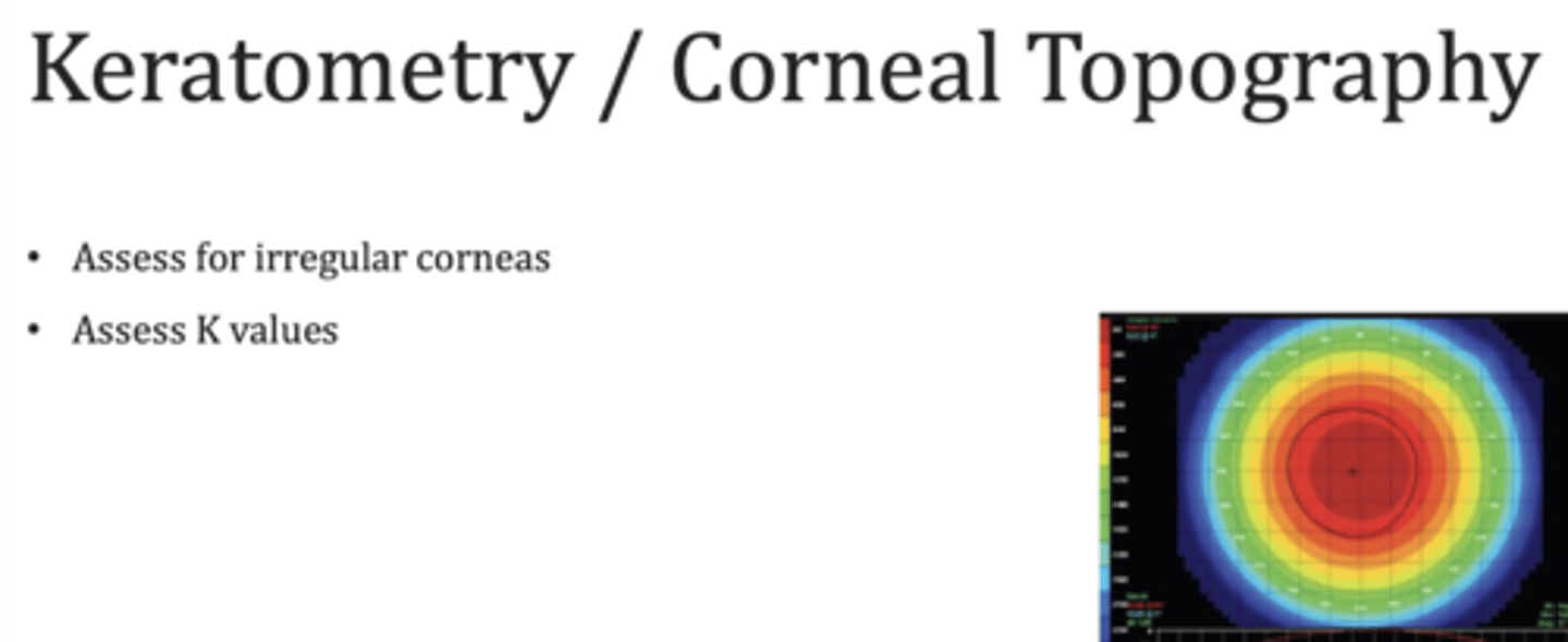 <p>The curvature of the anterior corneal surface</p>