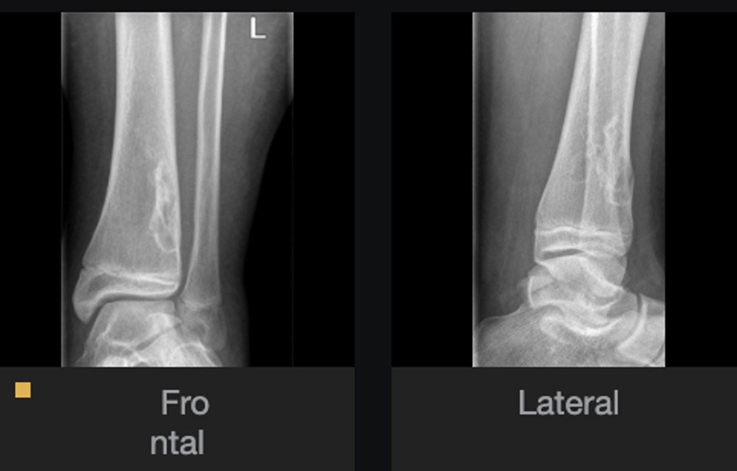 <p>Describe the lesion</p>