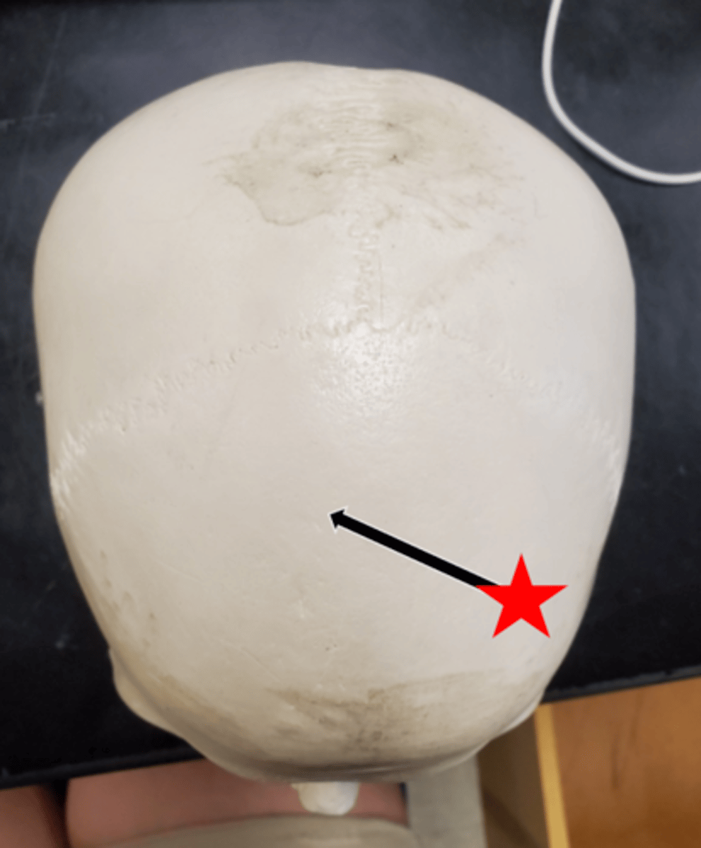 <p>Name the starred region in the image.</p>