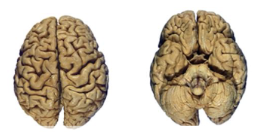 <p>which side is dorsal vs ventral views?</p>
