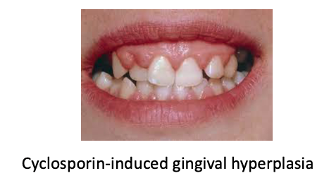 <p>gingival hyperplasia</p><p>poor healing</p><p>and infections</p>