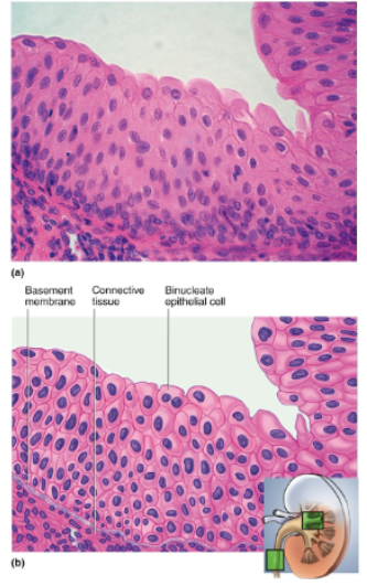 <p>Multilayered; surface cells change from round to flat when stretched</p>