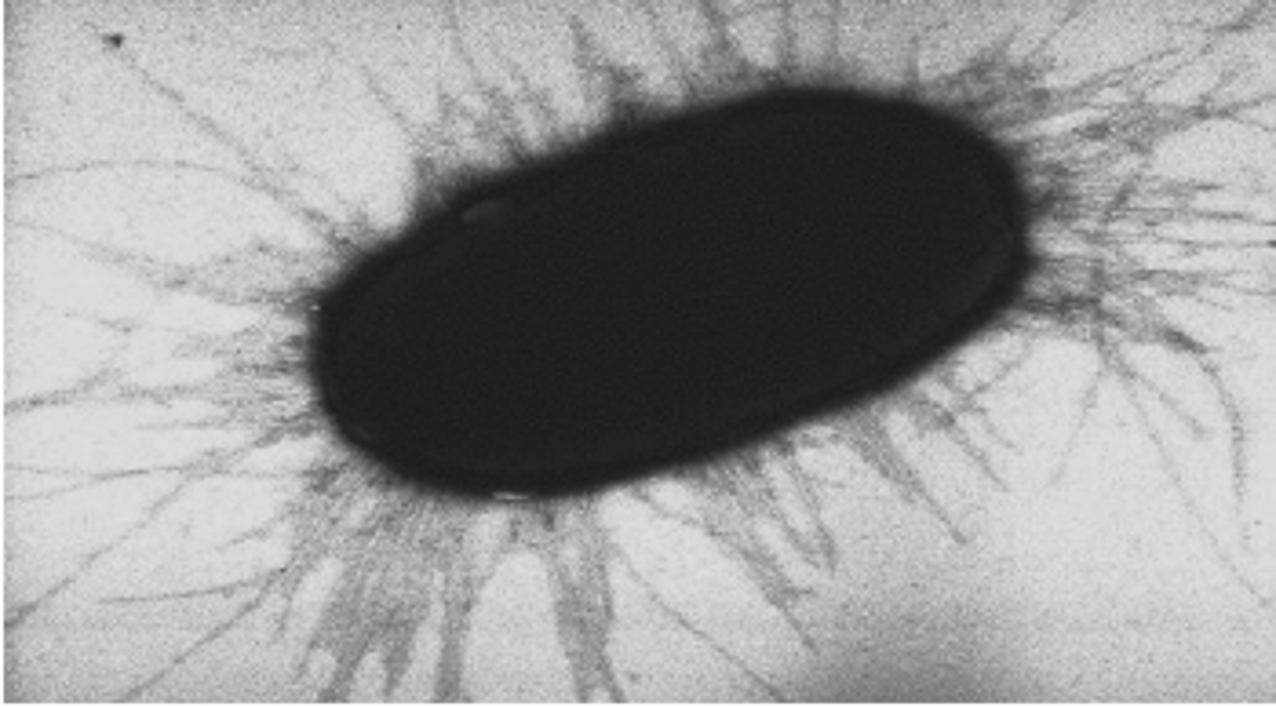 <p>what virulence factor is shown by this ETEC causing E. coli</p>