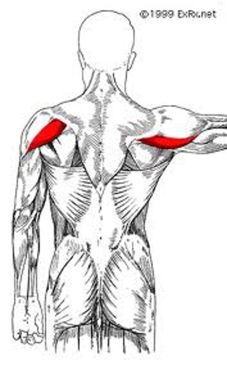 <p>What is this muscle, and what is its action, Proximal &amp; Distal insertions?</p>
