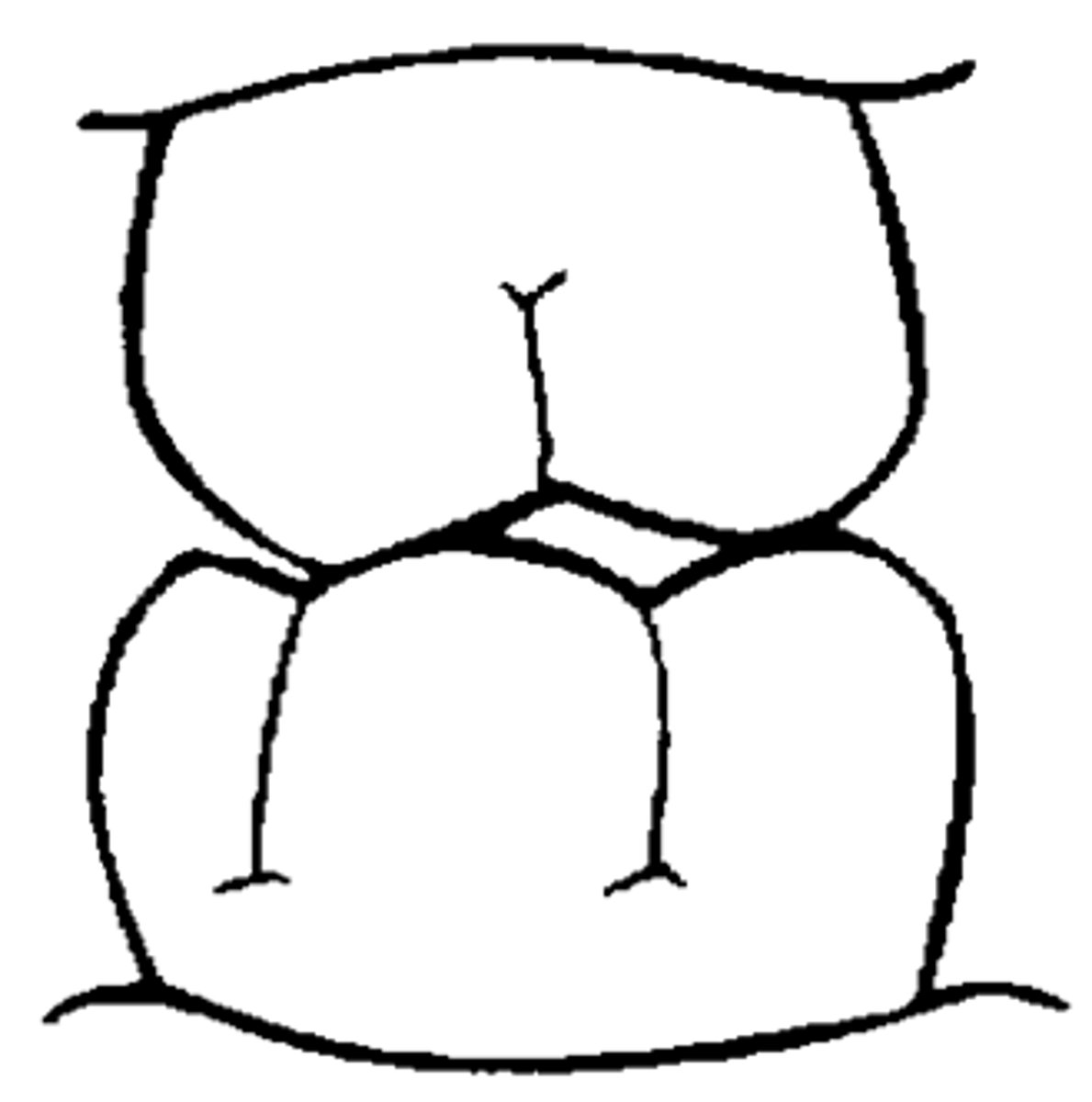 <p>Cusp-to-cusp relationship of Posterior teeth.</p>