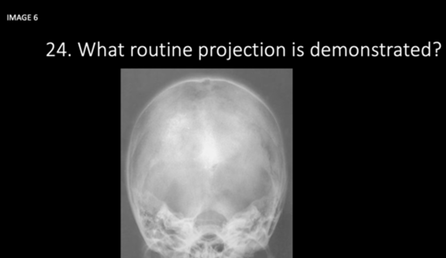 <p>What projection is this?</p>
