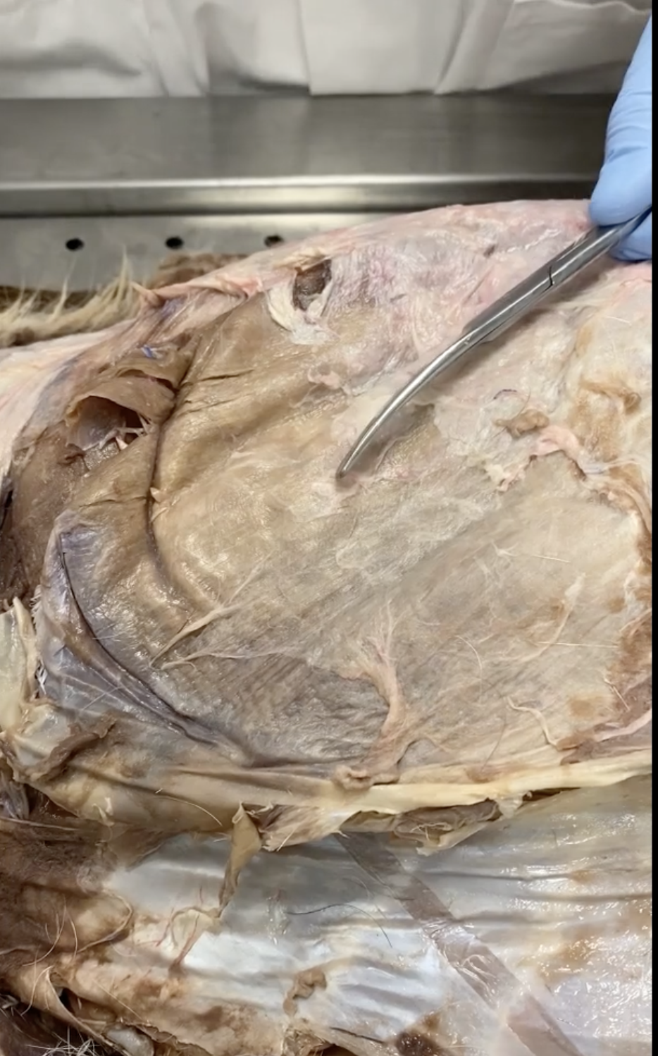 <p>In abdomen</p>