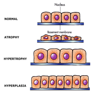 <p>Decrease in the size of cells&nbsp;</p><ul><li><p>Results in reduced tissue mass</p></li></ul><p></p>