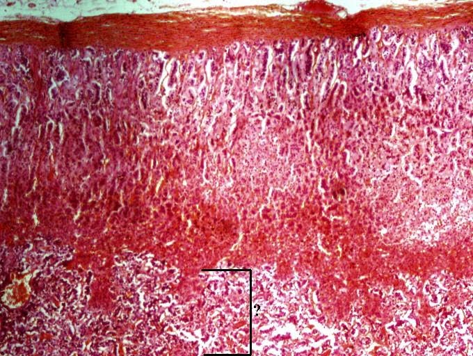 <p><span><span>Identify the indicated layer of the adrenal gland.</span></span></p>
