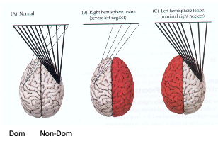 <p>non dominant </p>