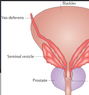 <p>Line at bottom right</p>