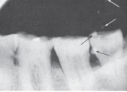 <p>What causes<strong> air bubbles</strong> in film? </p>