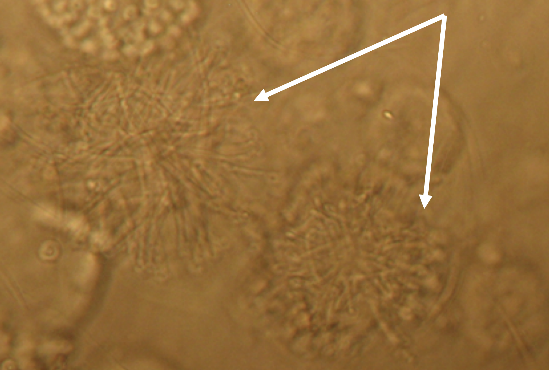 <p>This specimen was obtained from earthworm gonads. What might the denoted structures be, and what type of parasite are you looking at? Why are they hairy looking?</p>