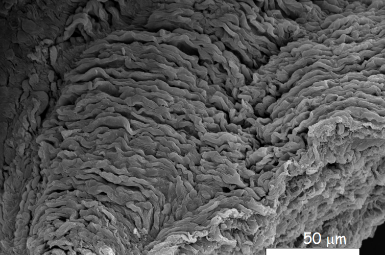 <p>Where is this epithelium</p>