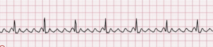 <p>Identify the rhythm! Discuss nursing and collaborative care</p>