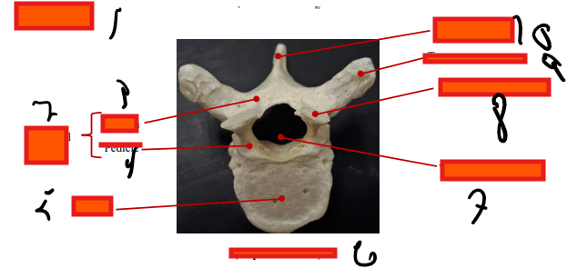 <p>Where is the spinous process</p>