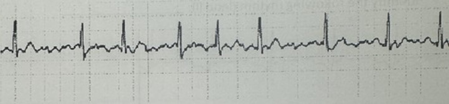 <p>identify the rhythm</p>