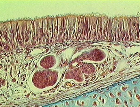 <p>Identify the type of epithelium, the cilia, cartilage, the lamina propria and serous glands</p>