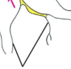 <p>Dendrites</p>