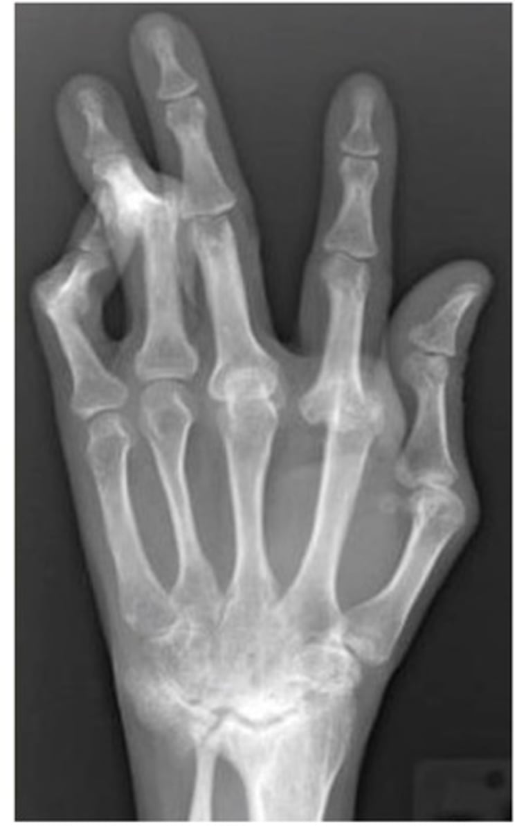 <p>What diagnosis is this?</p>