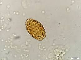 <p>Dictophyma renale</p>