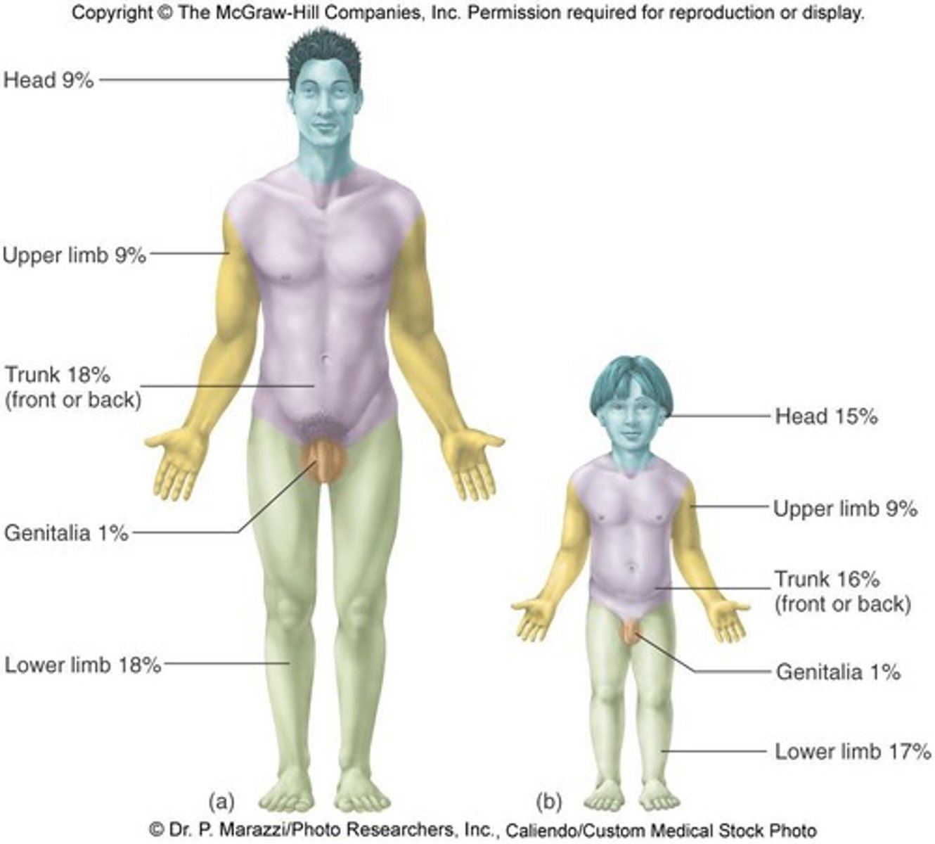<p>To estimate the severity of burns by dividing the body into areas that are approximately 9% of the total body area.</p>