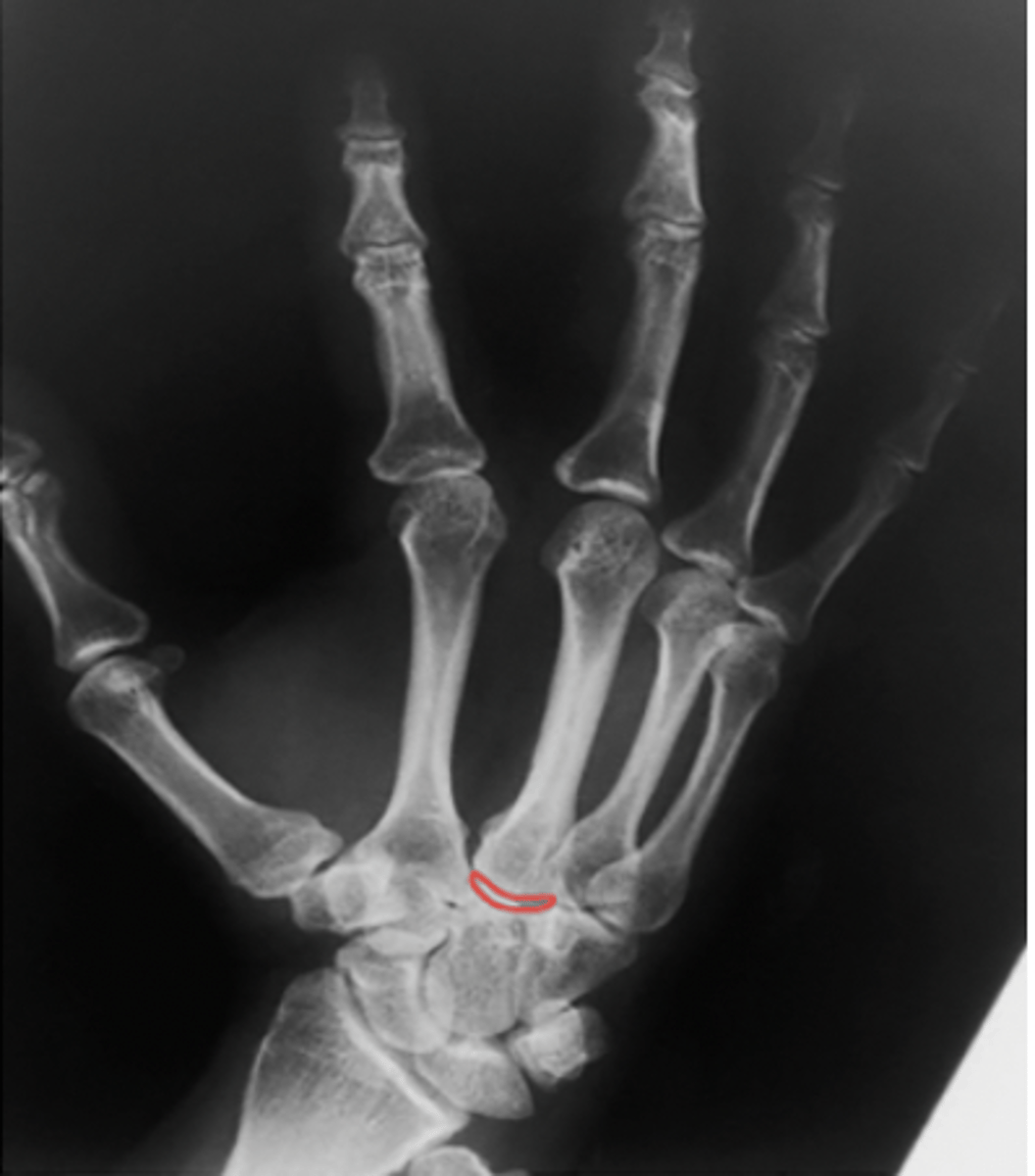 <p>What structure is highlighted?</p>