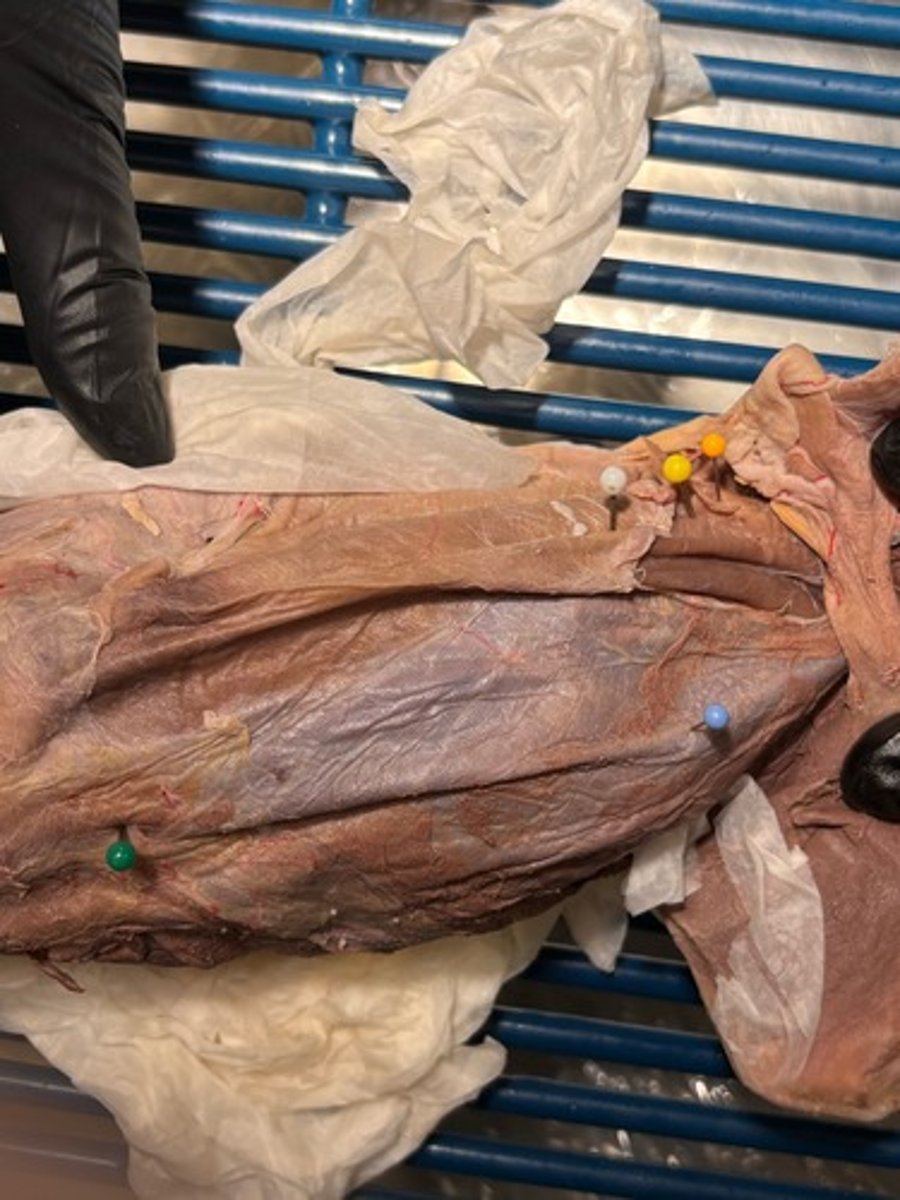 <p>What abdominal muscle is the yellow pin in</p>