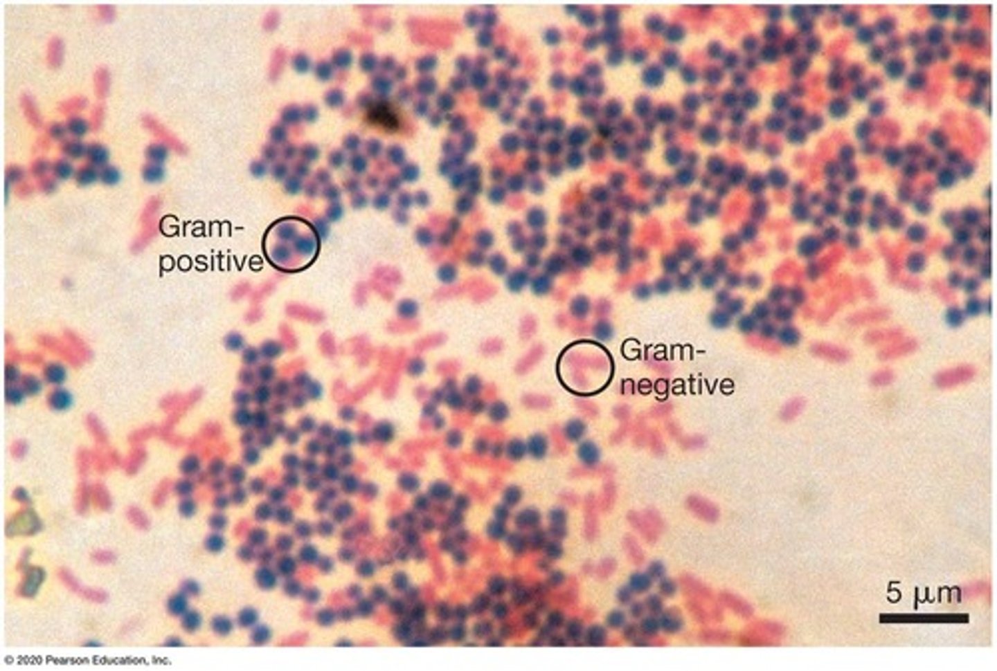 <p>Dyeing technique to classify bacterial cell walls.</p>