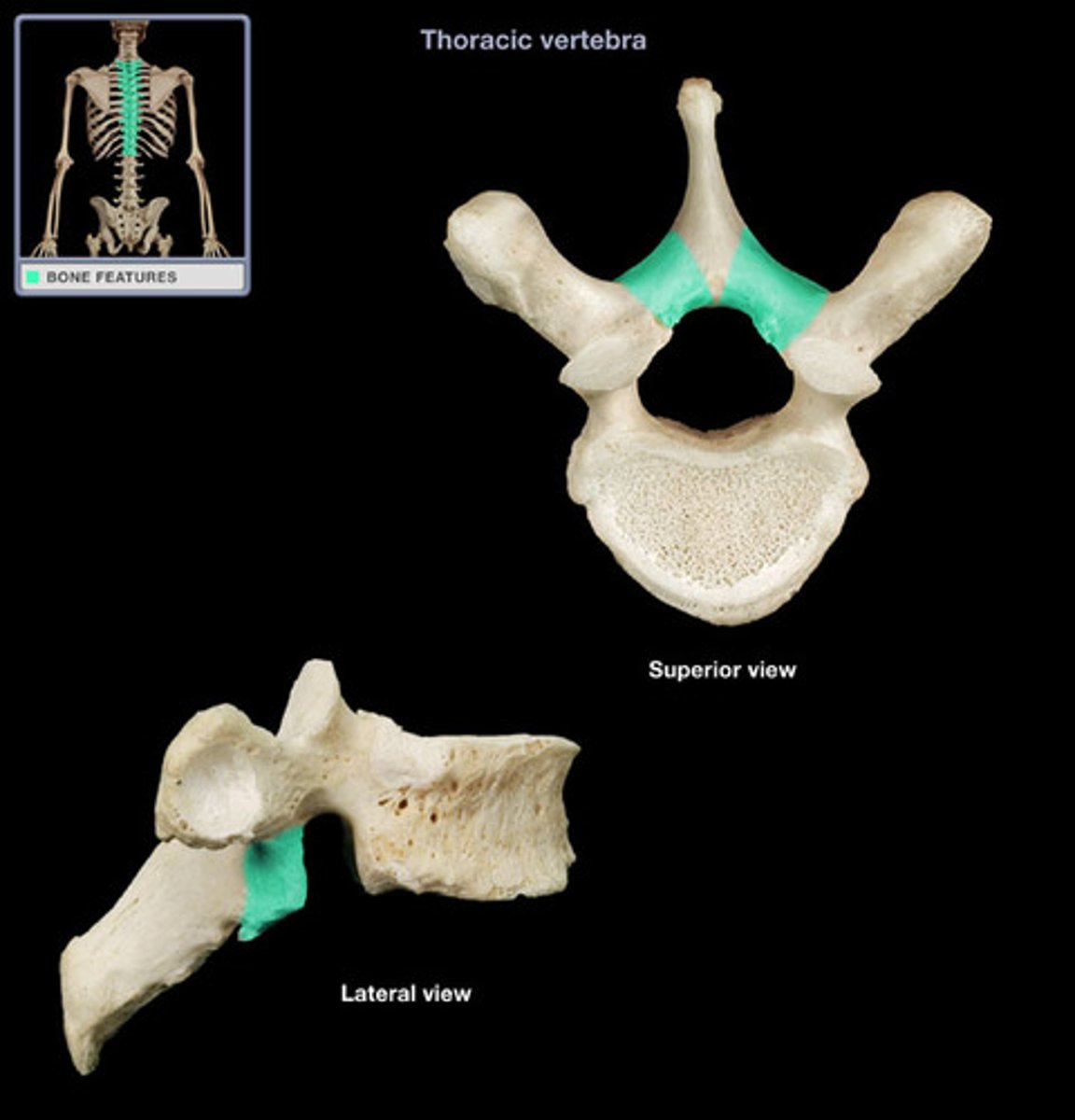 <p>supporting bone between the spikes of the vertebra</p>