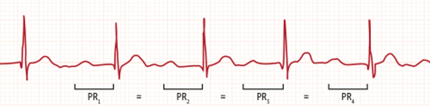 <p>prolonged PR interval</p>
