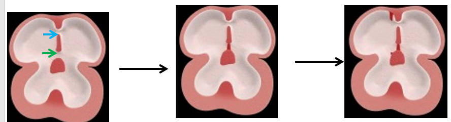 <ul><li><p><strong><mark data-color="red">primordial atrium, cushions</mark></strong></p></li><li><p><strong><mark data-color="red">opening, foramen primum, endocardial cushions</mark></strong></p></li><li><p><strong><mark data-color="red">decreases, disappears, endocardial cushion, septum</mark></strong></p></li><li><p><strong><mark data-color="red">primum, foramen secundum</mark></strong></p></li></ul>
