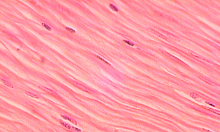 <p>What kind of muscle is pictured here?</p>