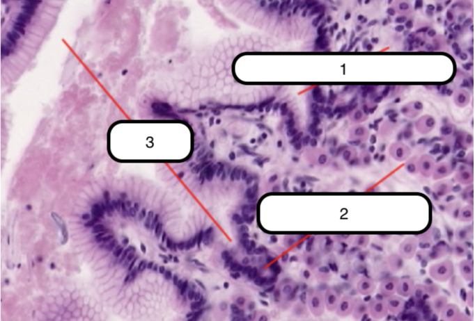 <p>In this slide, identify the structure labeled as #2</p>