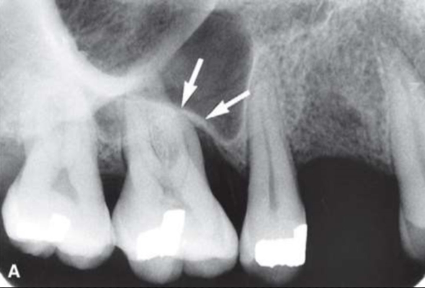 <p>Identify the structure</p>