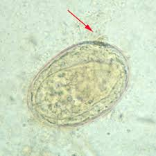 <p>Identify the 90 x 70 µm egg shown below.<br><br></p><p>Diphyllobothrium latum</p><p>Fasciola hepatica</p><p>Hymenolepis diminuta</p><p>Paragonimus westermani</p><p>Schistosoma japonicum</p>