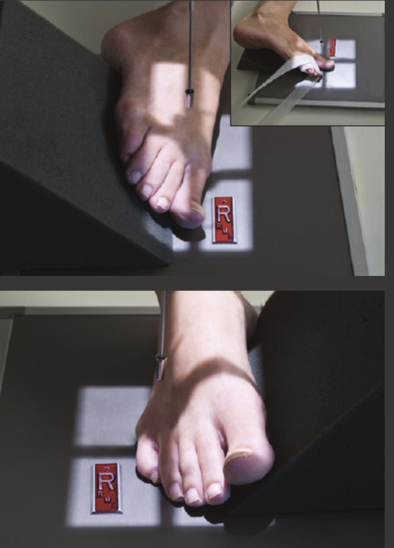 <p>Fine FS, 100cm</p><p>55kVp, 1mAs</p><p>Straight tube</p><p>CR: metatarsophalangeal joint</p>