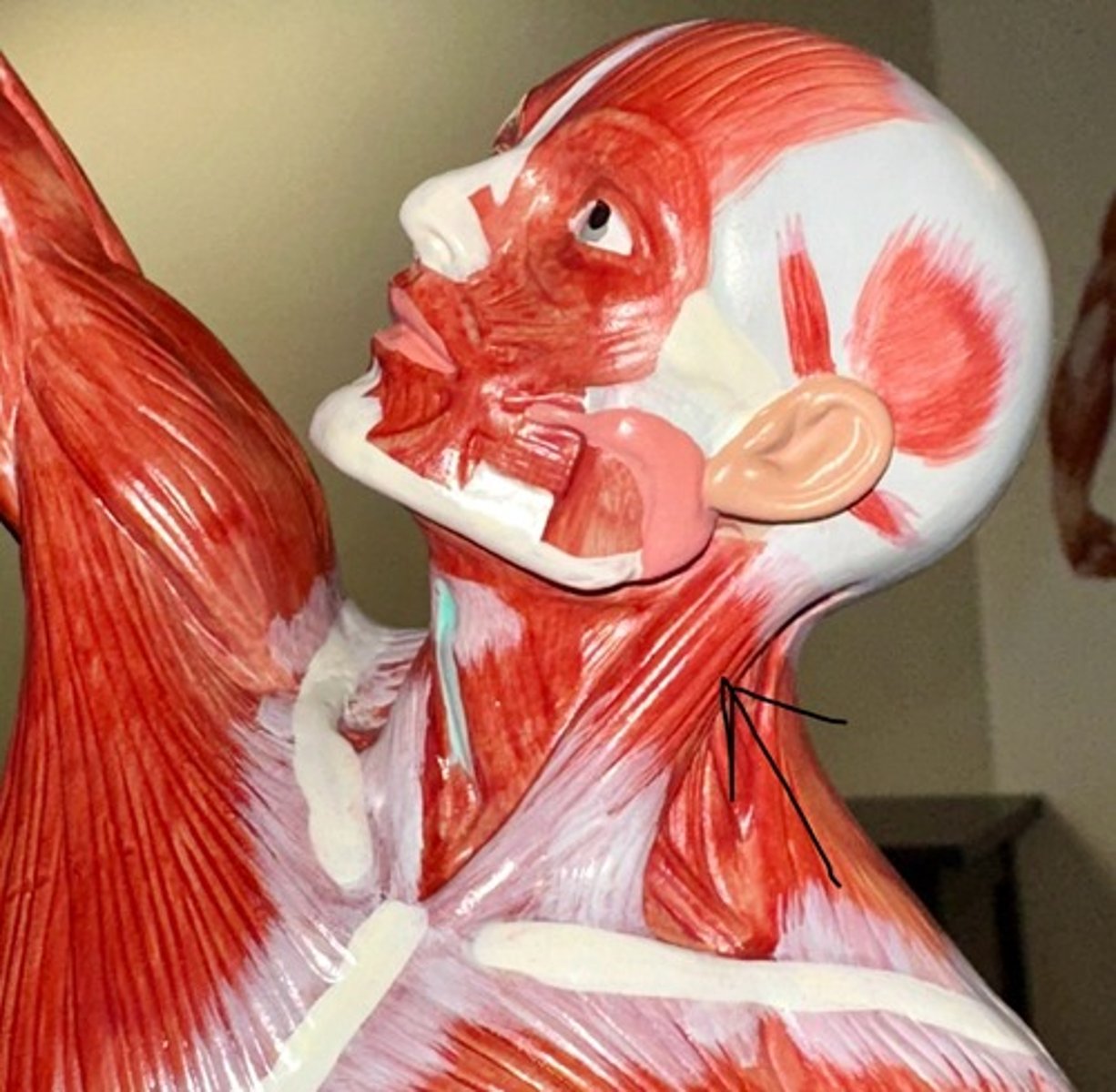 <p>What are the (3)<br>attachments of the Sternocleidomastoid?</p>